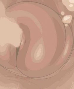 Dwarf Pound 009